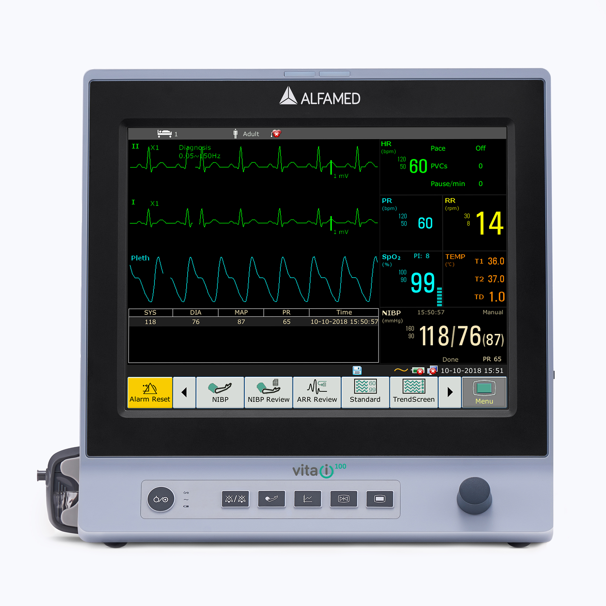 Monitor Multiparâmetros Vita i120 Tela 12.1″ – Alfamed